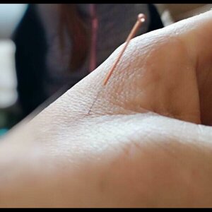 Acupunctuur Yi Xiao Tang image 2